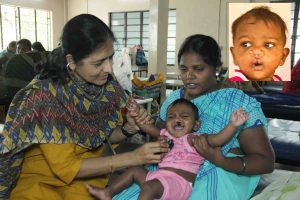 Dr. Geetha Examining a Cleft Lip Child